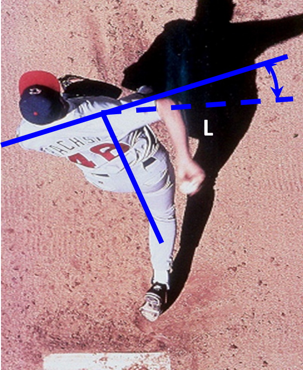 A graphic displaying angles drawn on a baseball player that measure the kinematic sequencing of a baseball pitch.